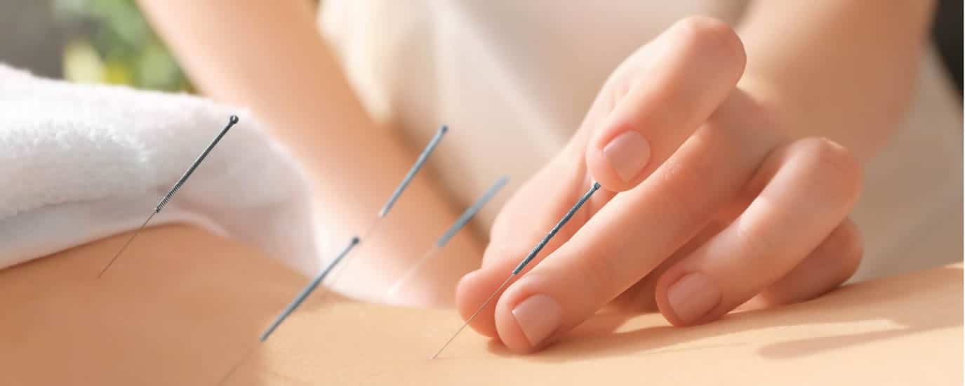 Find the benefits, uses, risks and generally how Acupuncture works.